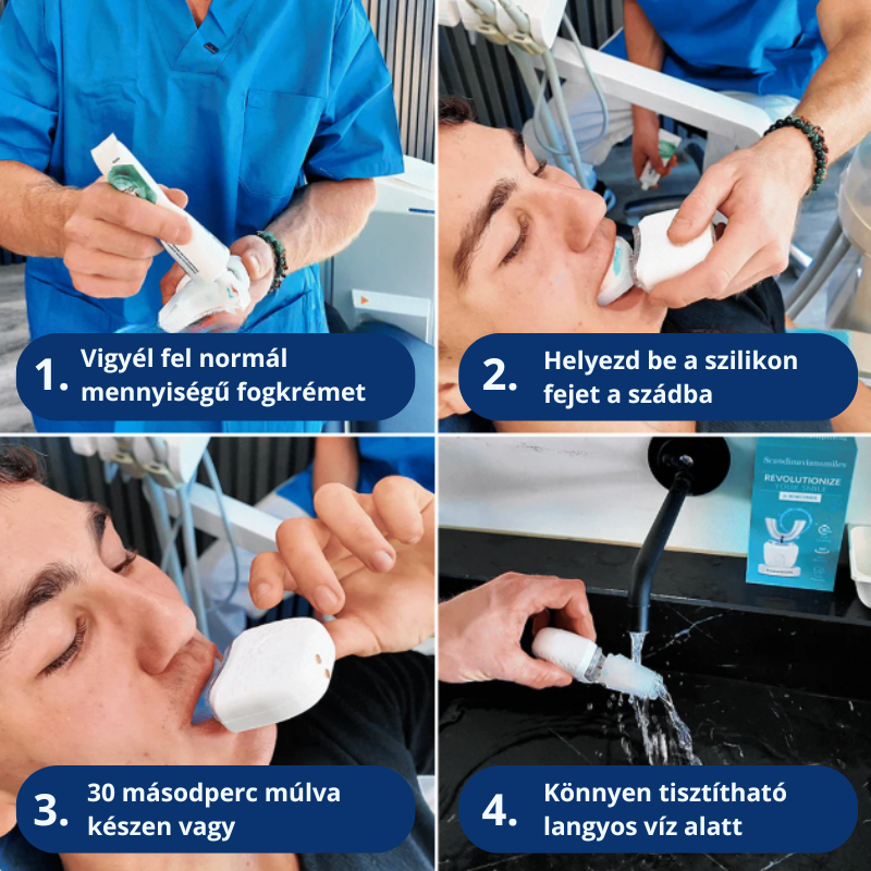 U-Clean™ Elektromos fogkefe